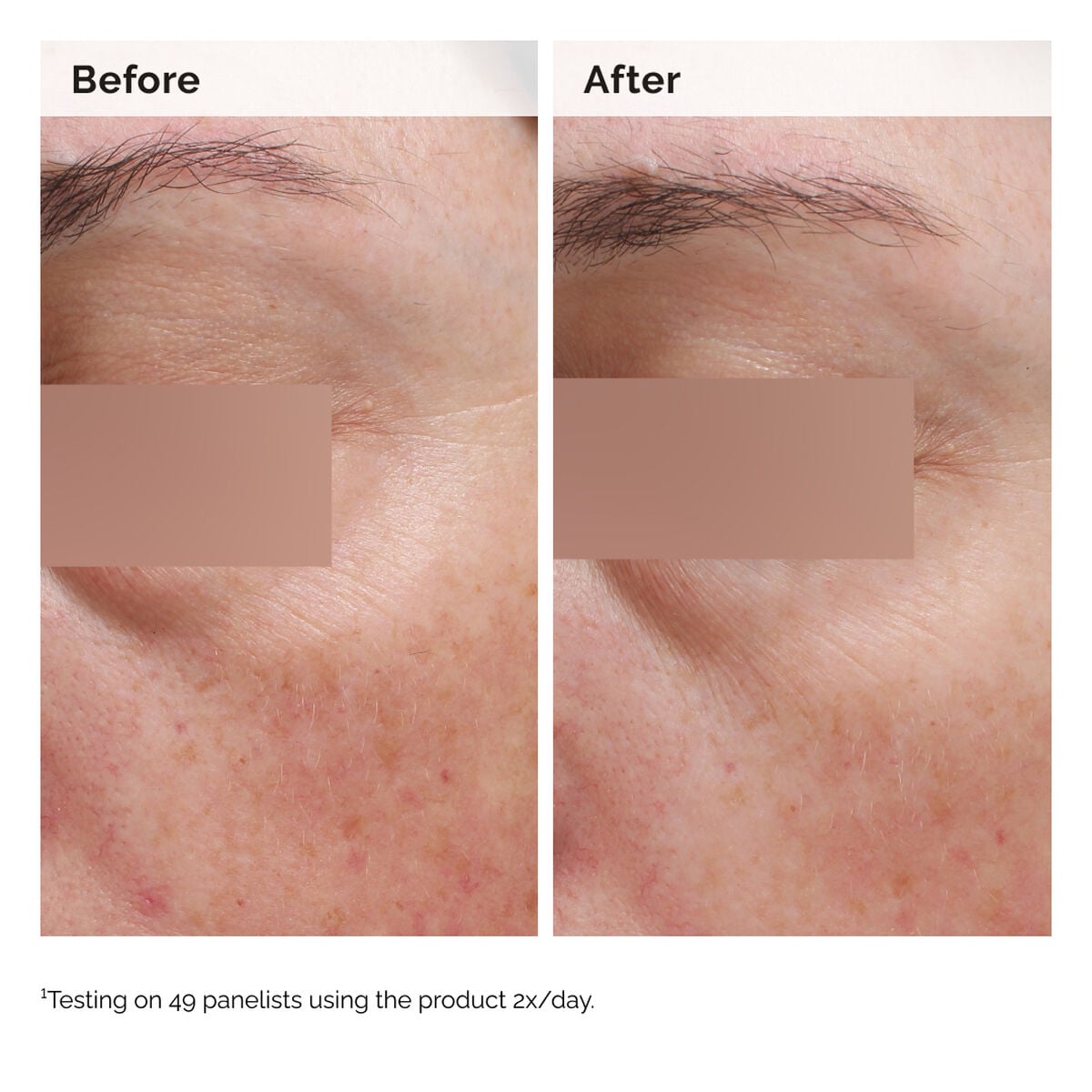 niacinamide-5-face-and-body-emulsion-j2 2024-08-23-ORD-Nia-5pct-Face-Body-B-A-Elasticity-Global-02-1x1.jpg
