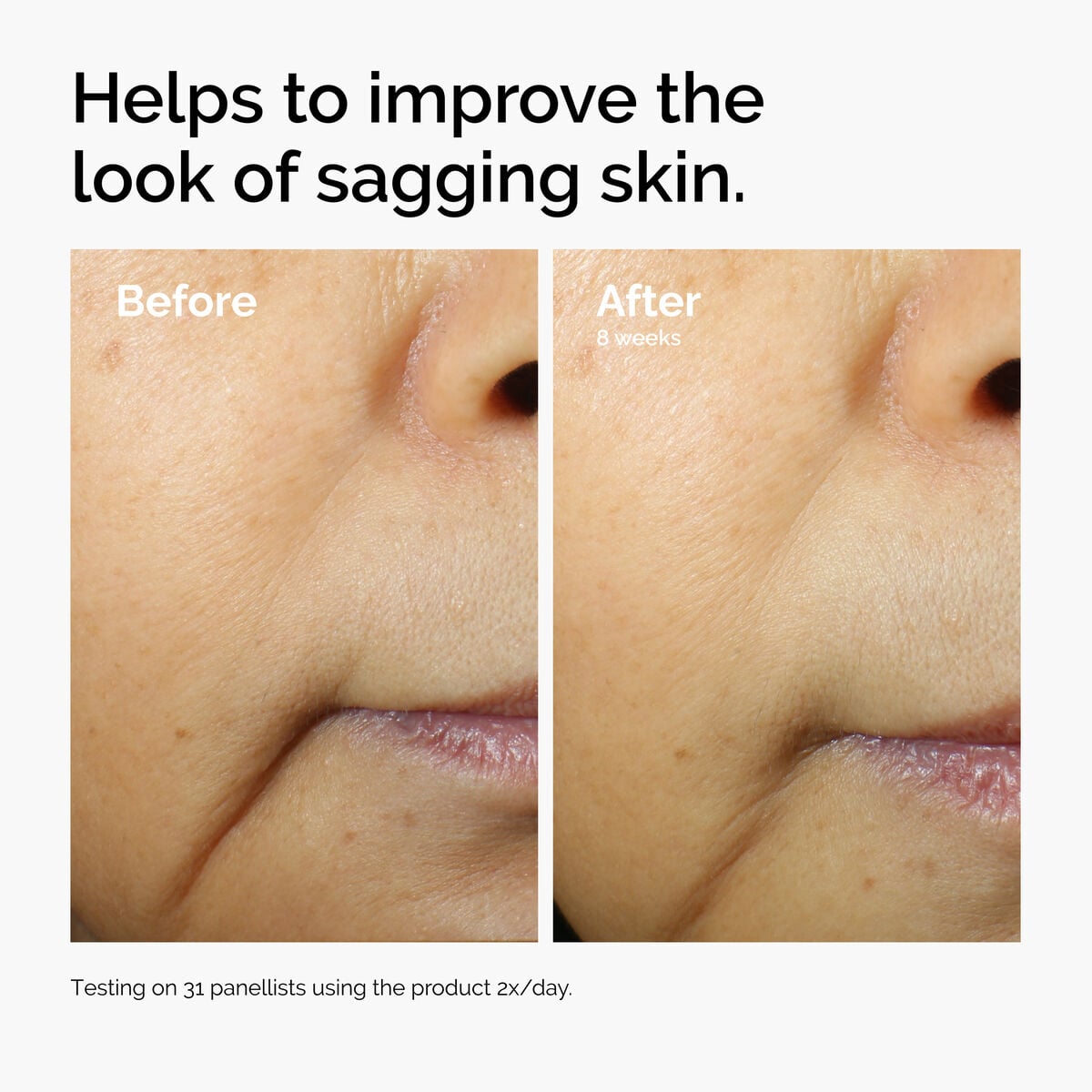 caffeine-3-escin-1-face-serum-f4 ord-caffeine-3pct-escin-1pct-face-serum-before-after-sagging.jpg