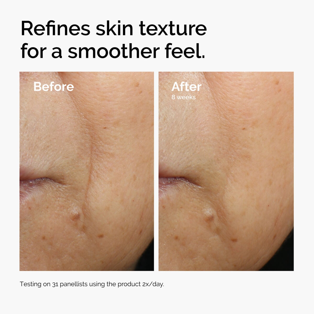 caffeine-3-escin-1-face-serum-f4 ord-caffeine-3pct-escin-1pct-face-serum-before-after-texture.jpg