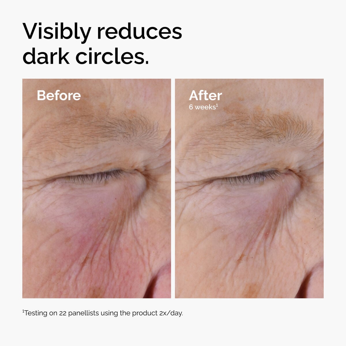 caffeine-solution-5-egcg-eye-serum-c9 ord-caffeine-solution-egcg-dark-circles-before-after.jpg