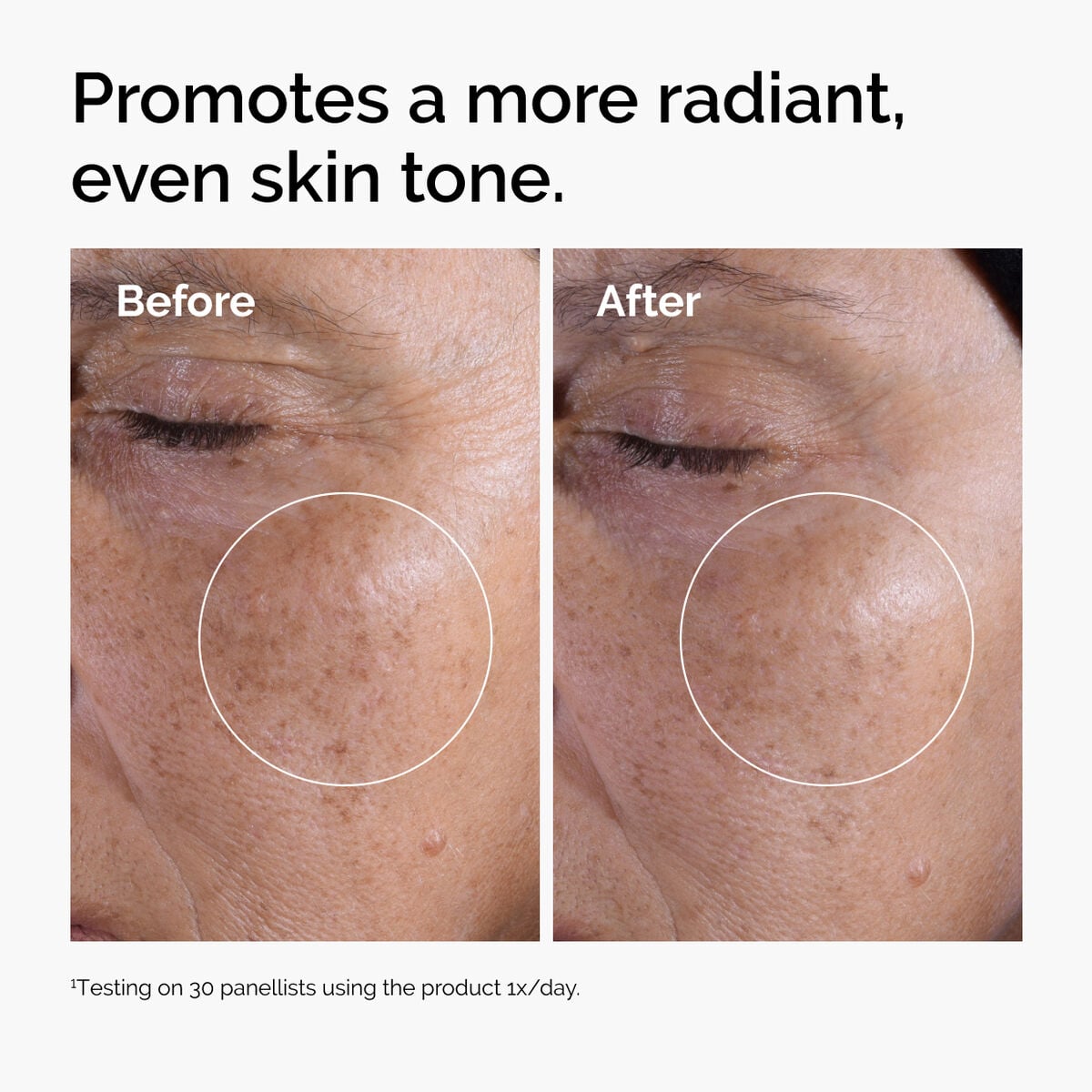 glycolic-acid-7-exfoliating-toner-r2 ord-glycolic-before-after-radiance.jpg