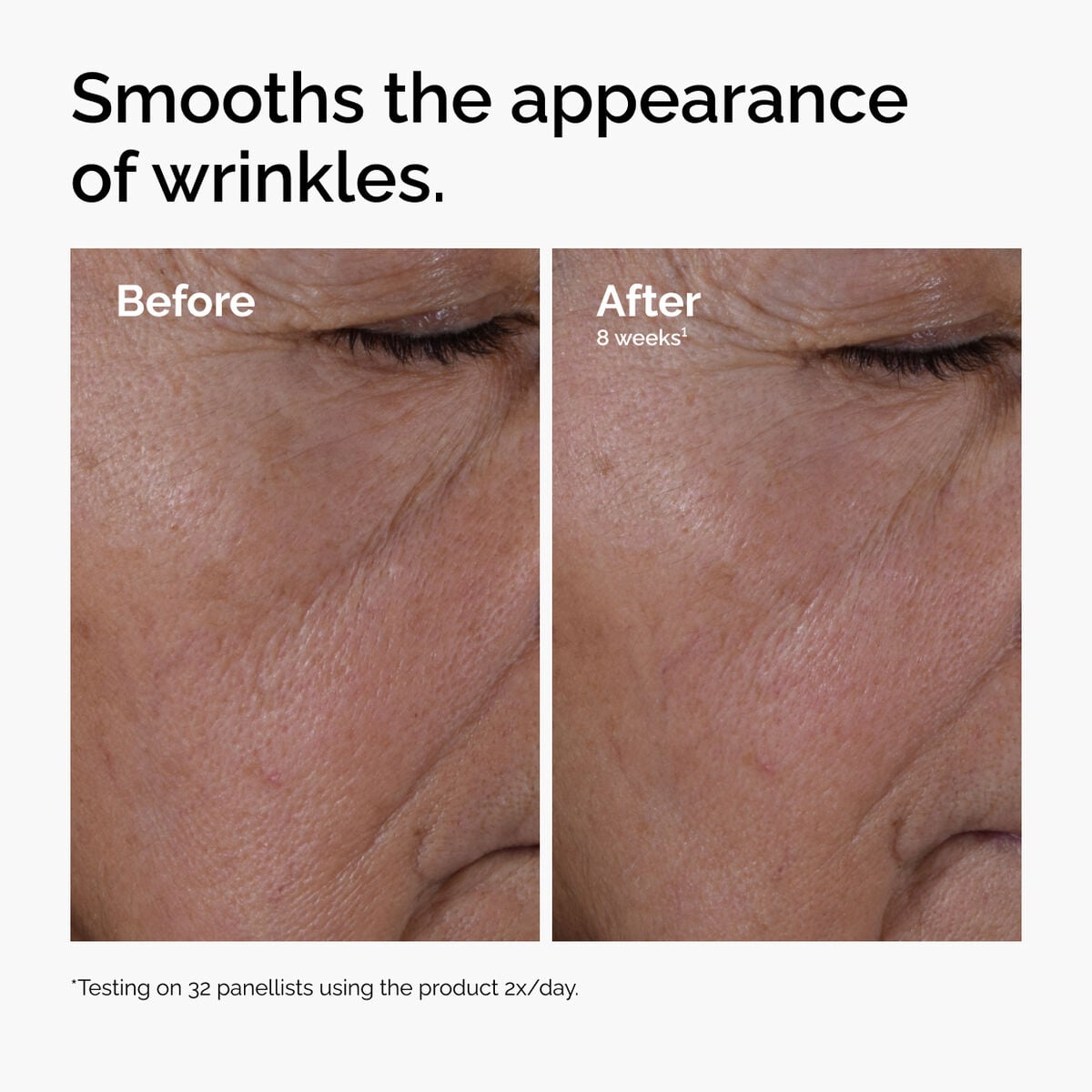 multi-peptide-ha-serum-c7 ord-multi-peptide-ha-serum-wrinkles-before-after.jpg