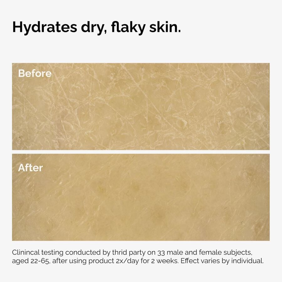 the-body-care-collection-r2 ord-natural-moisturizing-factors-inulin-body-before-after-graphic-02.jpg