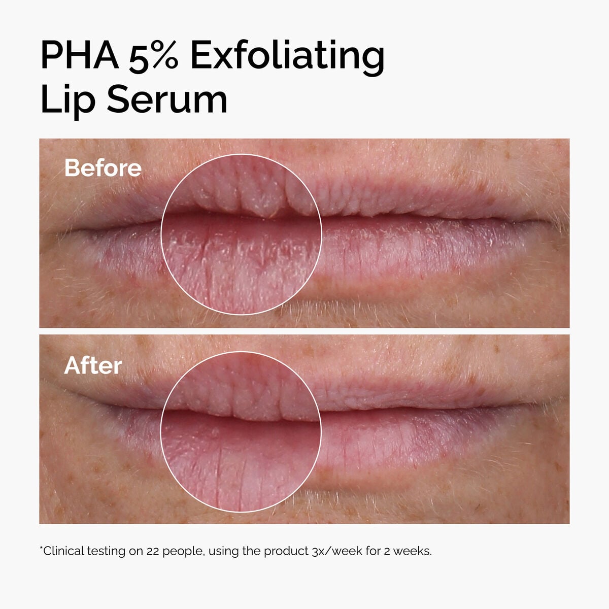 pha-5-exfoliating-lip-serum-l3 ord-pha-5pct-lip-exfoliating-serum-before-after.jpg